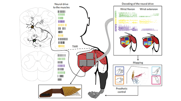 The robot arm controlled by the brain